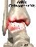 MOST SUCCESSFUL TREATMENT OF OSTEOARTHRITIS